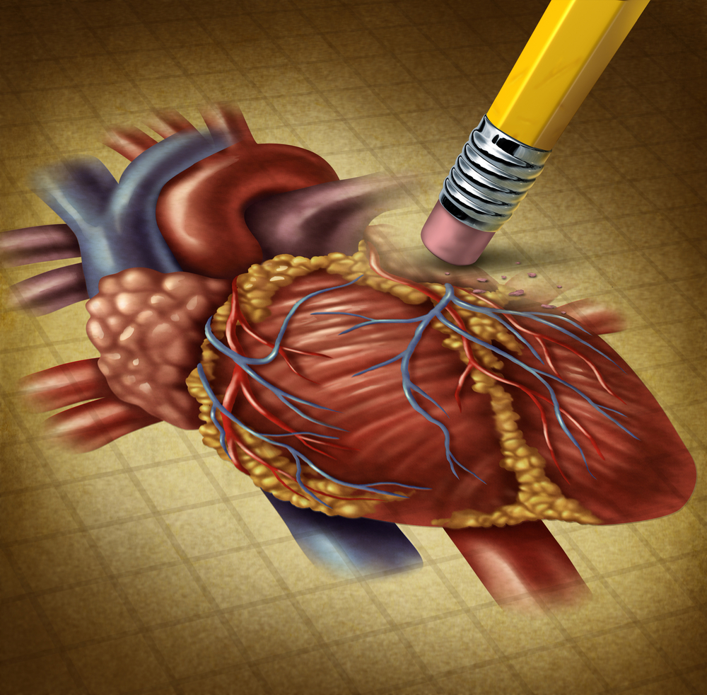Heart Decline in MD