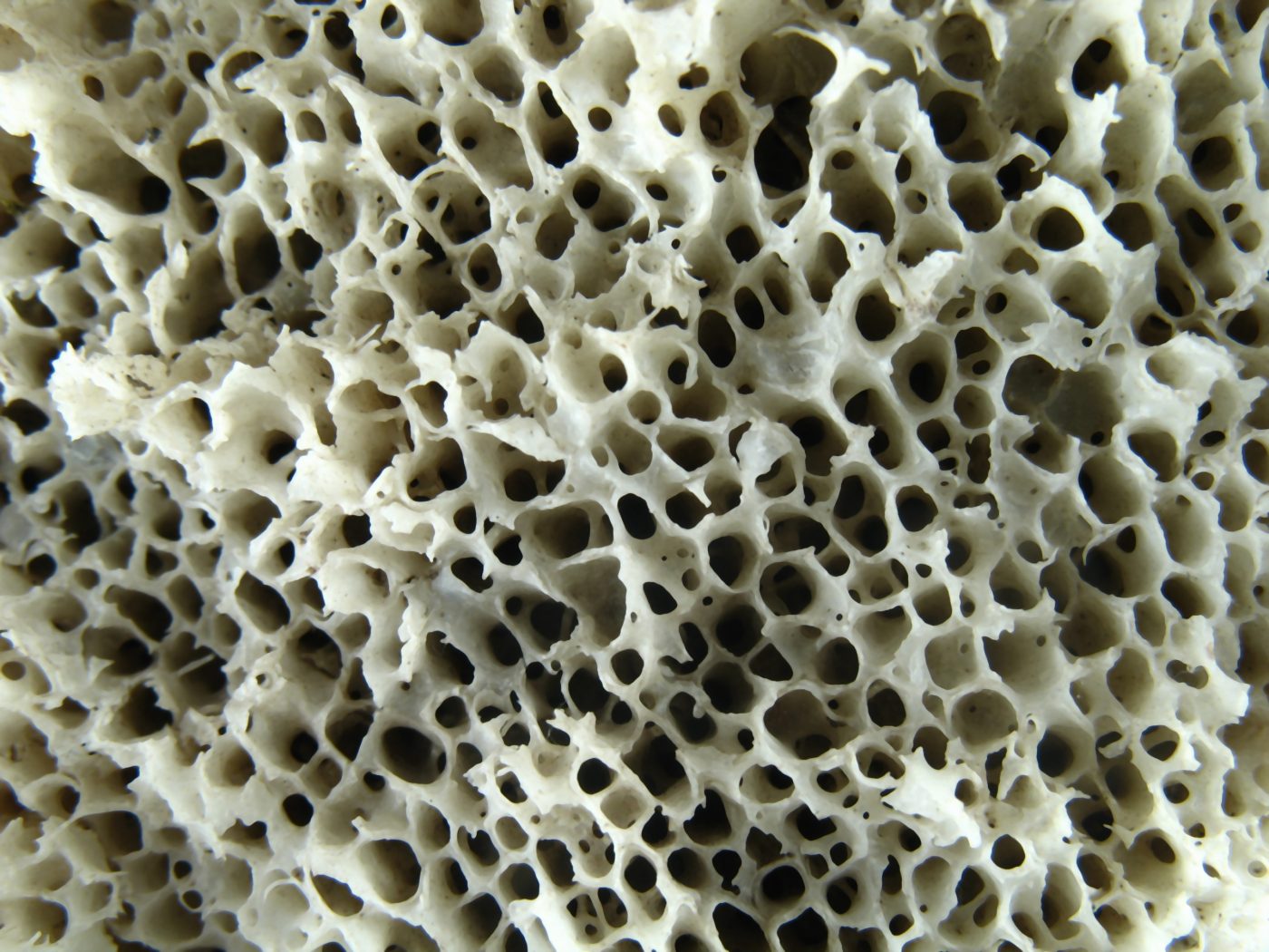 bone structure in DMD