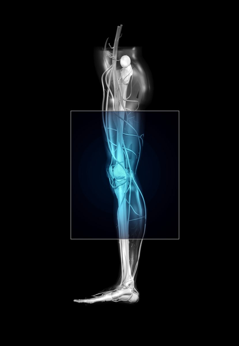 Radiologic imaging techniques