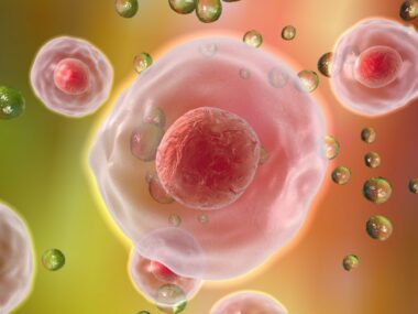 Duchenne MD and macrophages