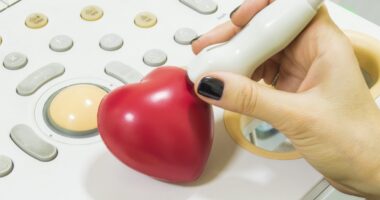heart monitor