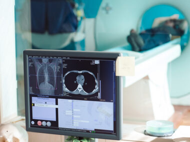 MRI for muscle tests