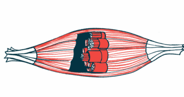 An illustration shows the structure of a muscle.