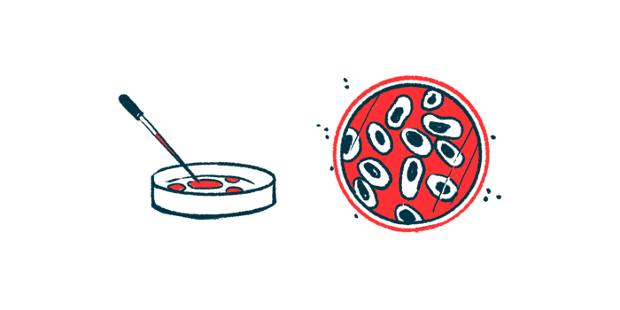 treatment of duchenne muscular dystrophy | Muscular Dystrophy News | illustration of a cell and cells in a petri dish