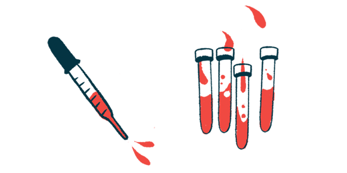 A squirting dropper is pictured alongside four vials, each half-filled with blood.