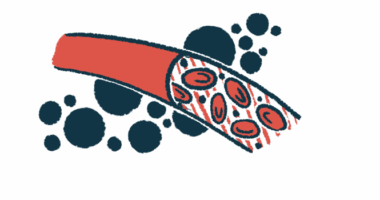 An illustration shows a blood vessel.