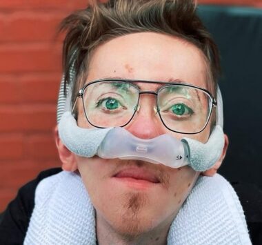 A close-up photo of the author, who has muscular dystrophy.